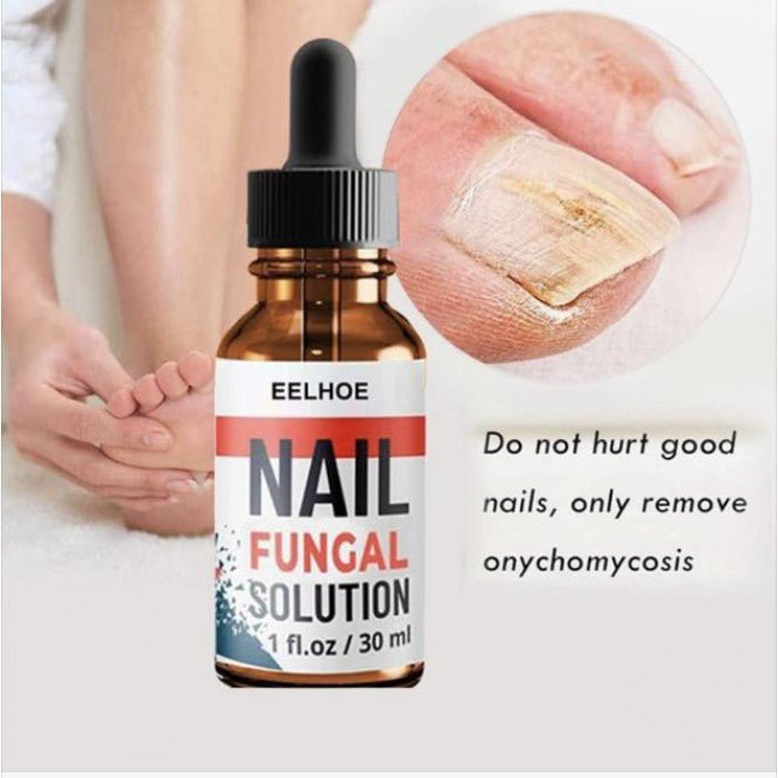 Antigljivični Serum za Nokte 3+1 GRATIS - SAMO KLIKNI