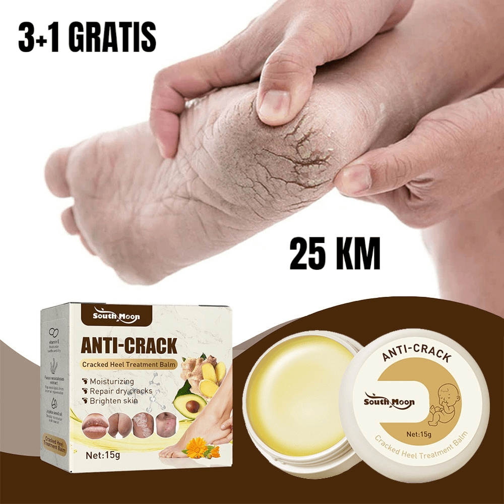 Krema za Ispucale Pete – – – slika 1